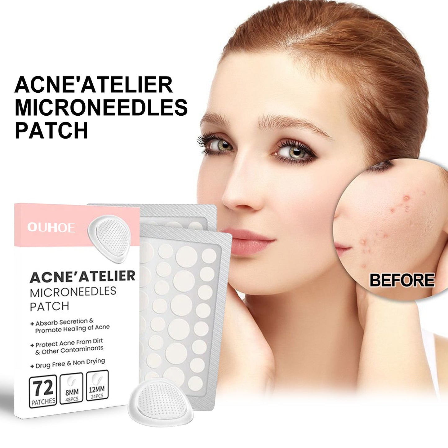 Acne Patch, Repair Acne Pimple Facial Redness Clean Pores Moisturize Skin Patch - DivineLink1 | Electronics, Fitness, Household Essentials | Shop