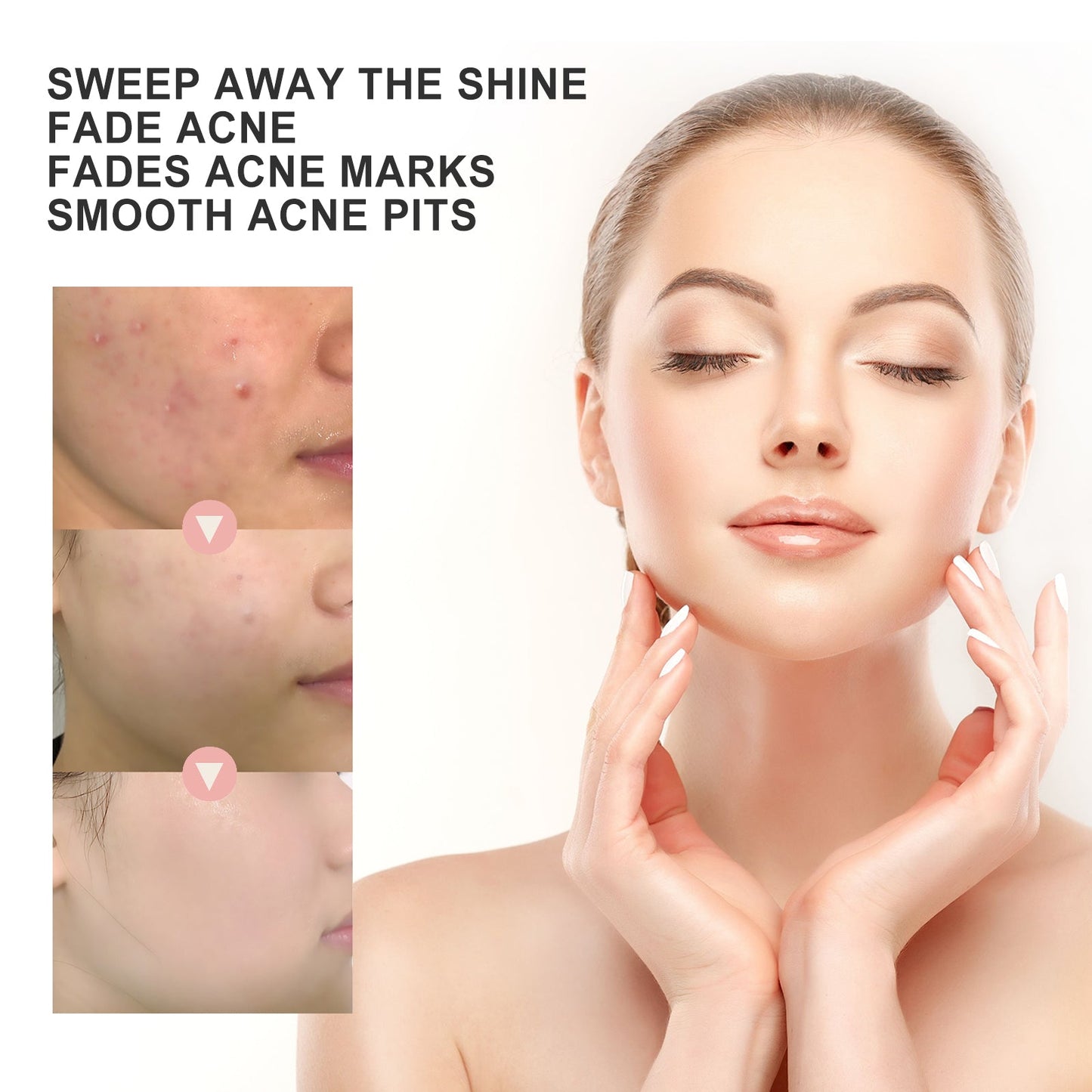Acne Patch, Repair Acne Pimple Facial Redness Clean Pores Moisturize Skin Patch - DivineLink1 | Electronics, Fitness, Household Essentials | Shop