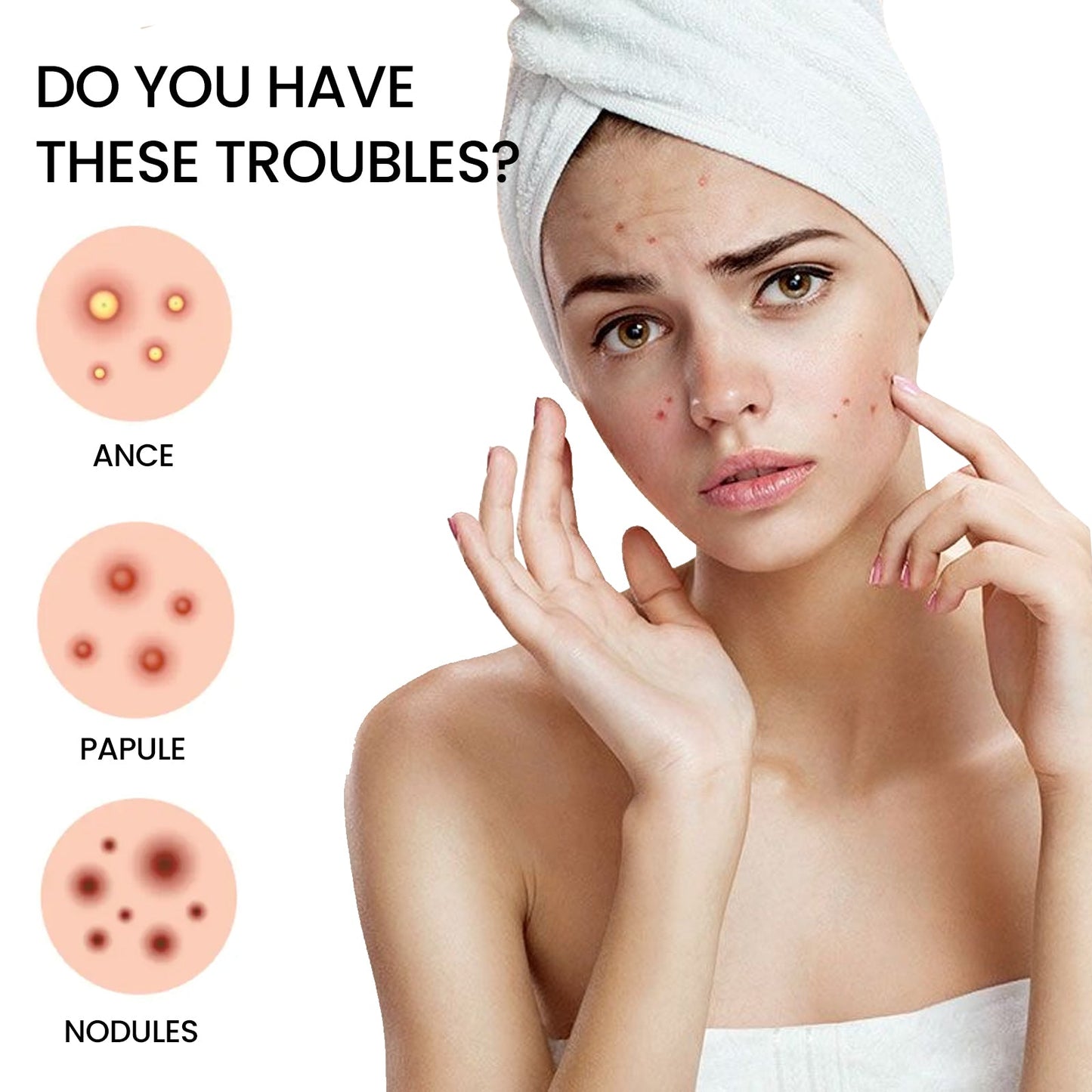 Acne Patch, Repair Facial Acne Invisible Concealer Hydrocolloid Patch - DivineLink1 | Electronics, Fitness, Household Essentials | Shop
