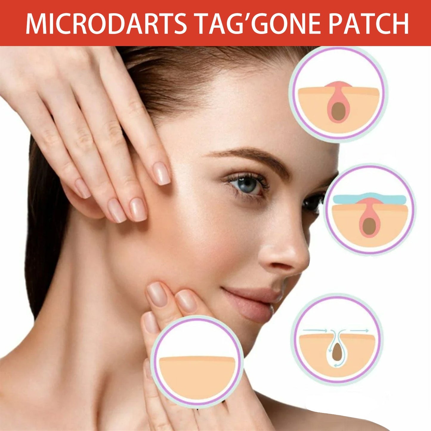 Acne Patch, Skin Clean Acne Pimple Moles Gram Wart Corns Spot Patch - DivineLink1 | Electronics, Fitness, Household Essentials | Shop