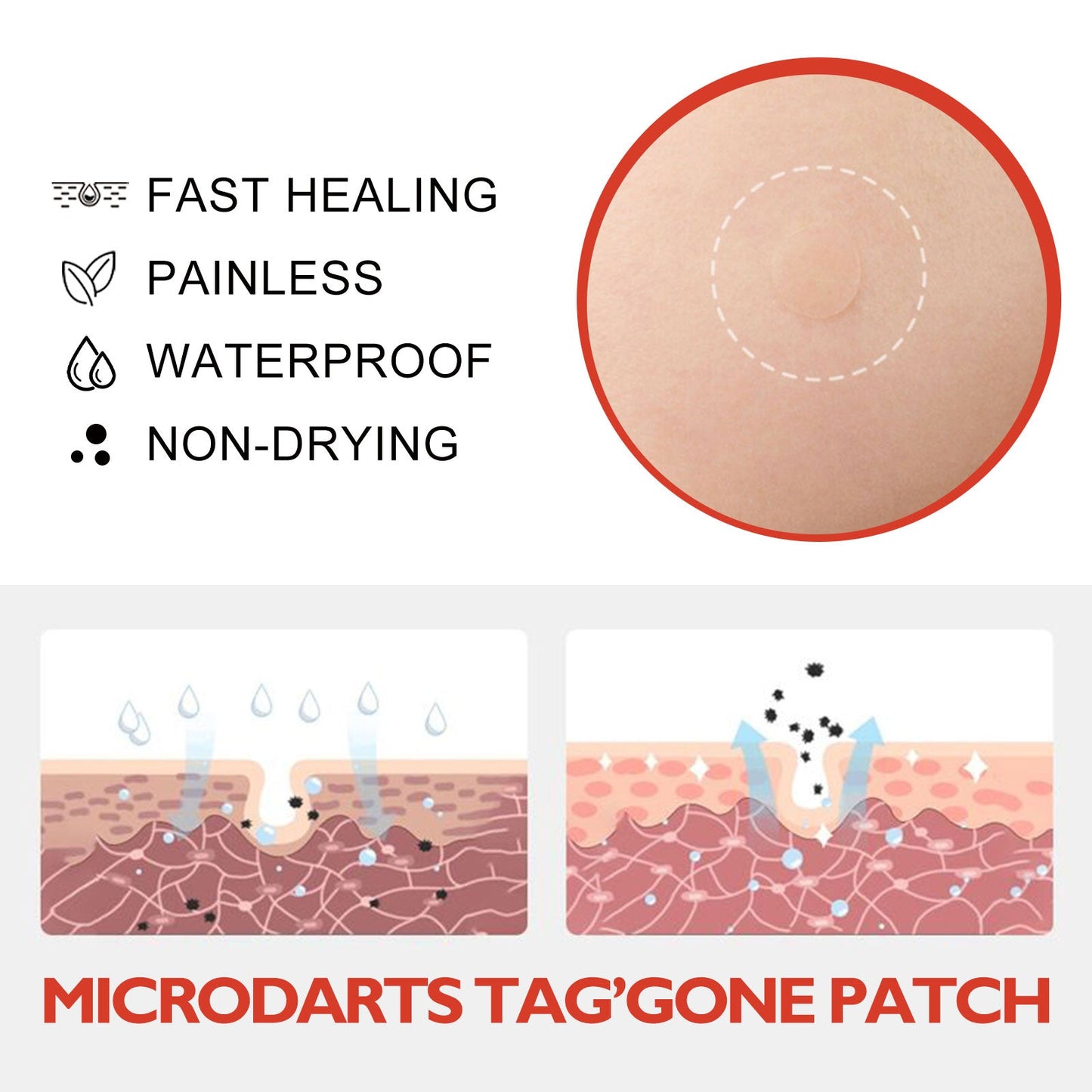 Acne Patch, Skin Clean Acne Pimple Moles Gram Wart Corns Spot Patch - DivineLink1 | Electronics, Fitness, Household Essentials | Shop
