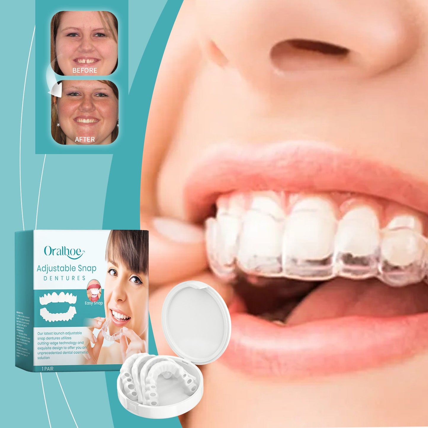Adjustable Buckle Dentures, Comfortable Adjustable Dentures To Fit The Mouth Chewing Force And Fit The Teeth - DivineLink1 | Electronics, Fitness, Household Essentials | Shop