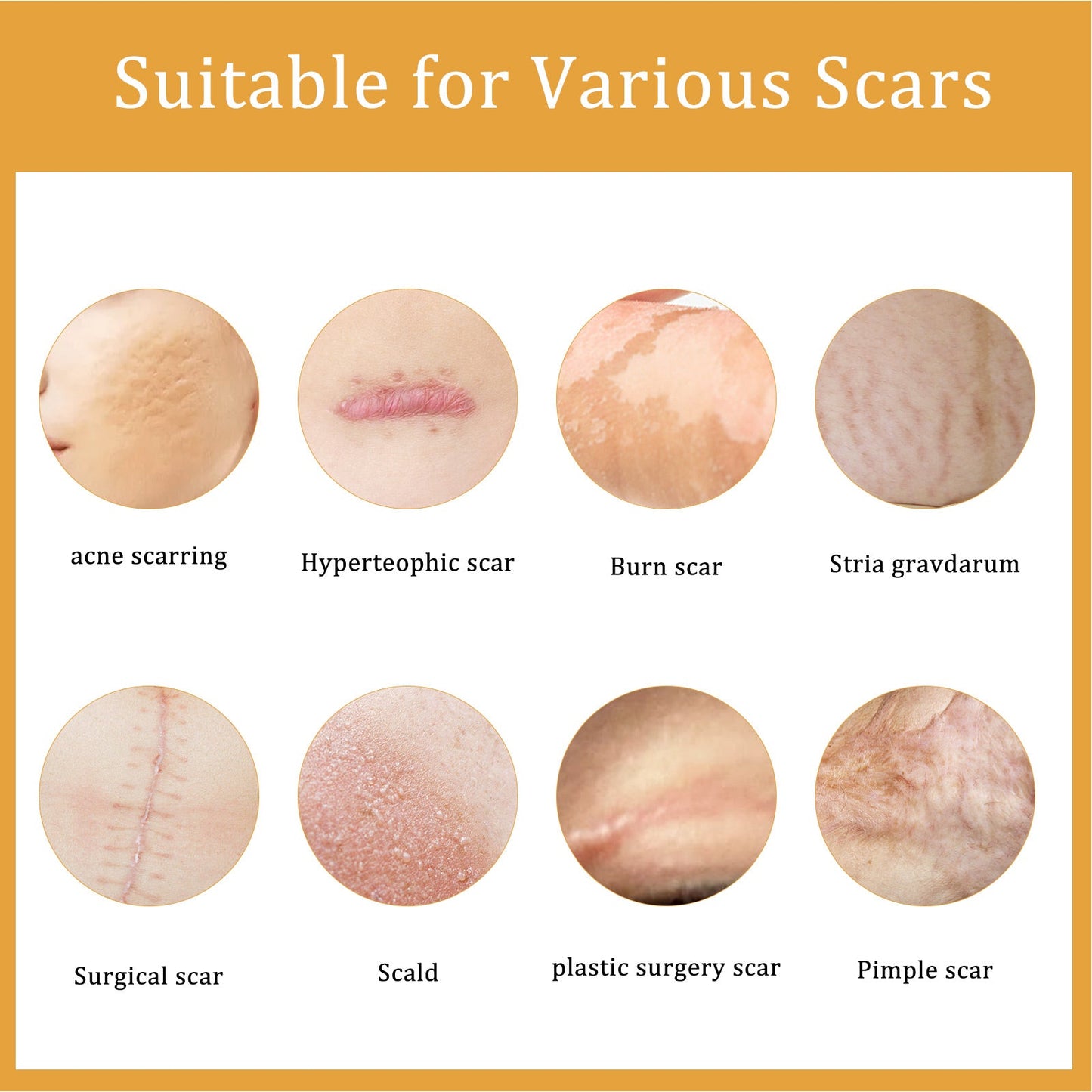 Desalting Skin Scar Cream, Skin Burn Scalding Surgical Scar Wound Repair Cream - DivineLink1 | Electronics, Fitness, Household Essentials | Shop
