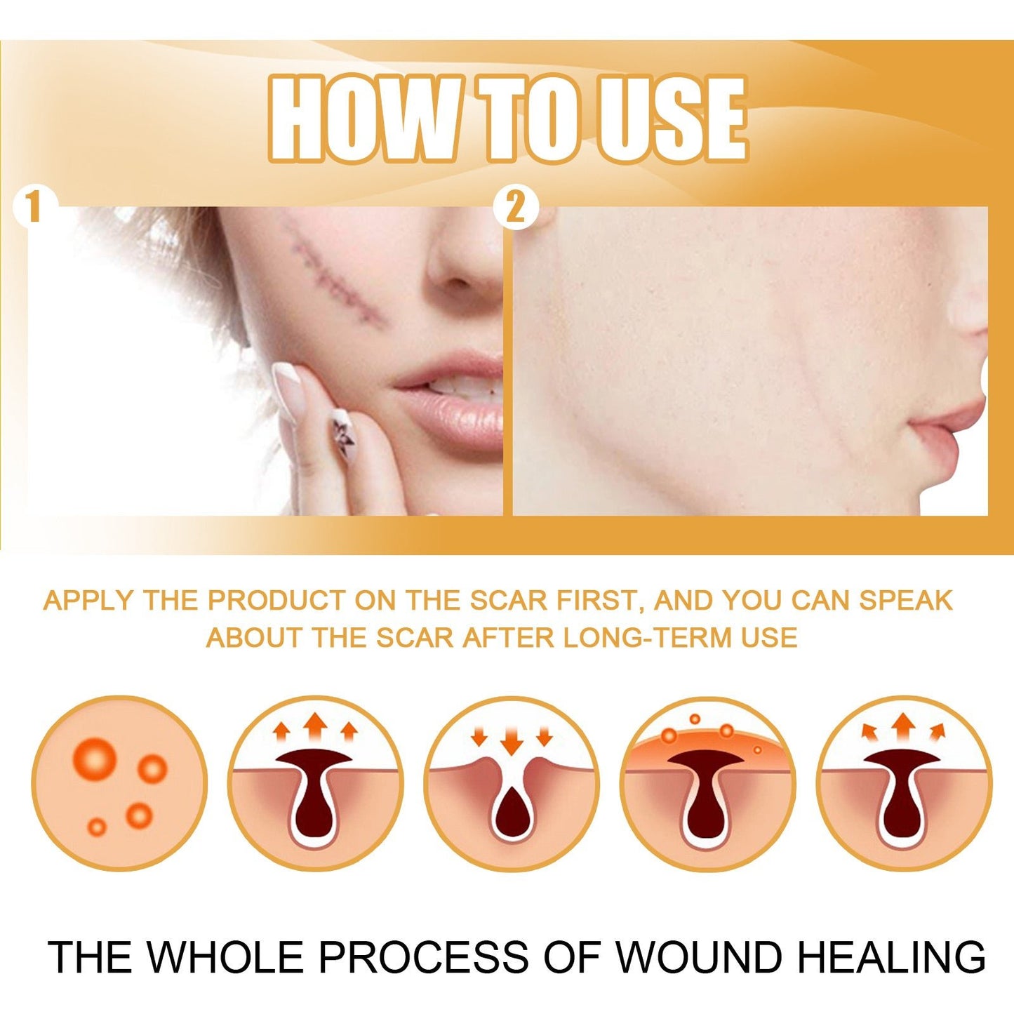 Desalting Skin Scar Cream, Skin Burn Scalding Surgical Scar Wound Repair Cream - DivineLink1 | Electronics, Fitness, Household Essentials | Shop