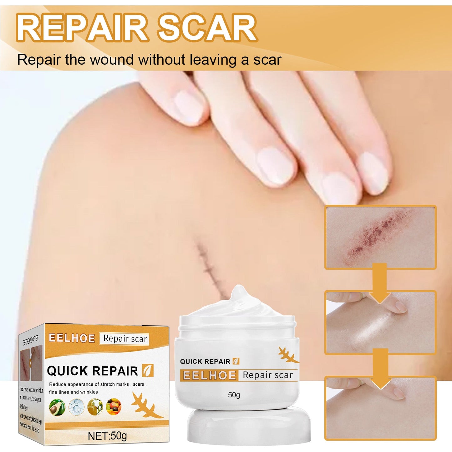 Desalting Skin Scar Cream, Skin Burn Scalding Surgical Scar Wound Repair Cream - DivineLink1 | Electronics, Fitness, Household Essentials | Shop