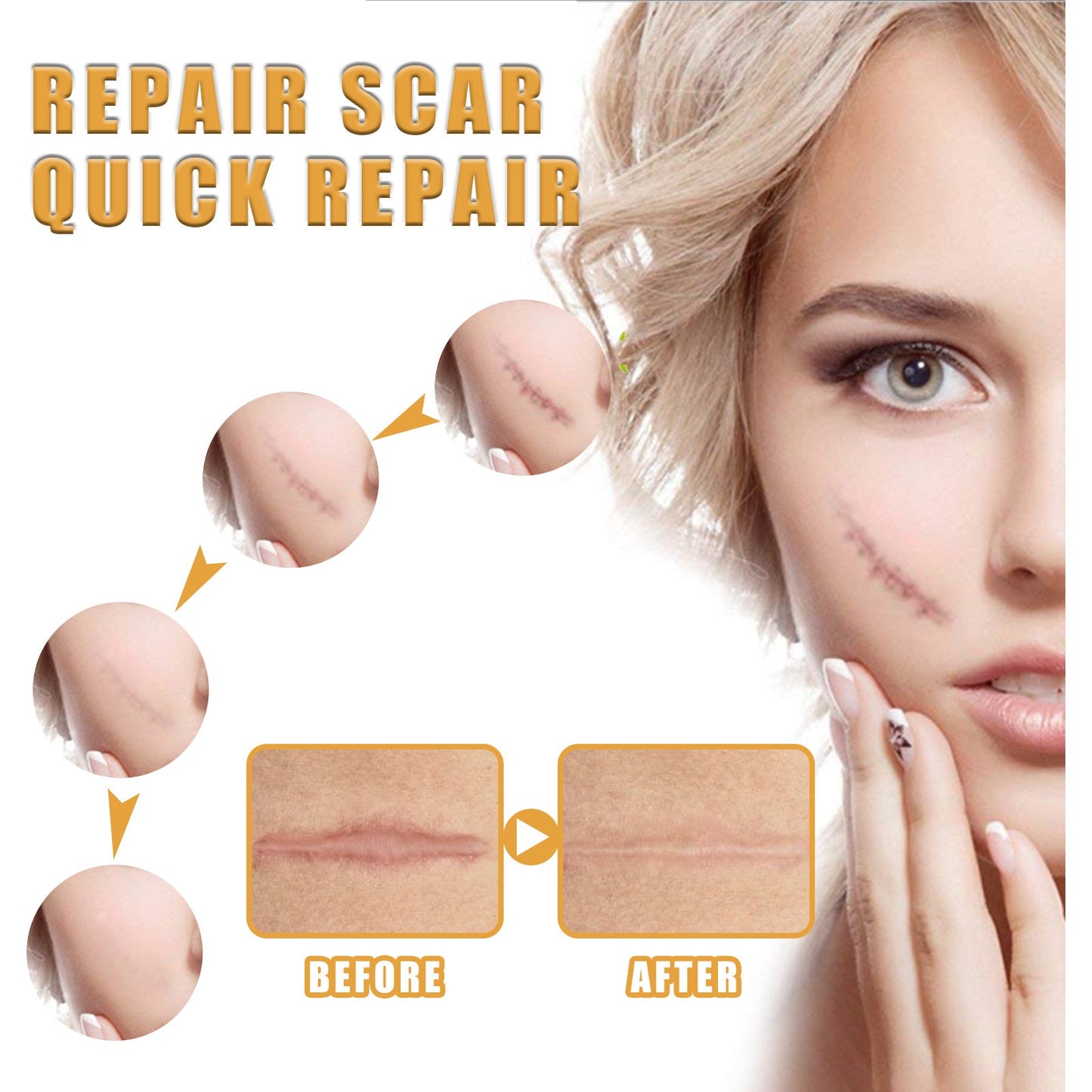 Desalting Skin Scar Cream, Skin Burn Scalding Surgical Scar Wound Repair Cream - DivineLink1 | Electronics, Fitness, Household Essentials | Shop