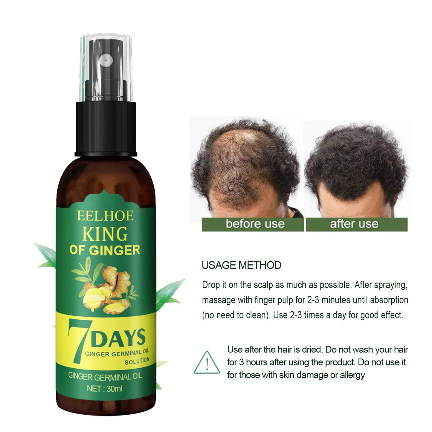 EEL Ginger Hair Spray, Strengthens Hair, Massages Scalp And Restores Hair - DivineLink1 | Electronics, Fitness, Household Essentials | Shop