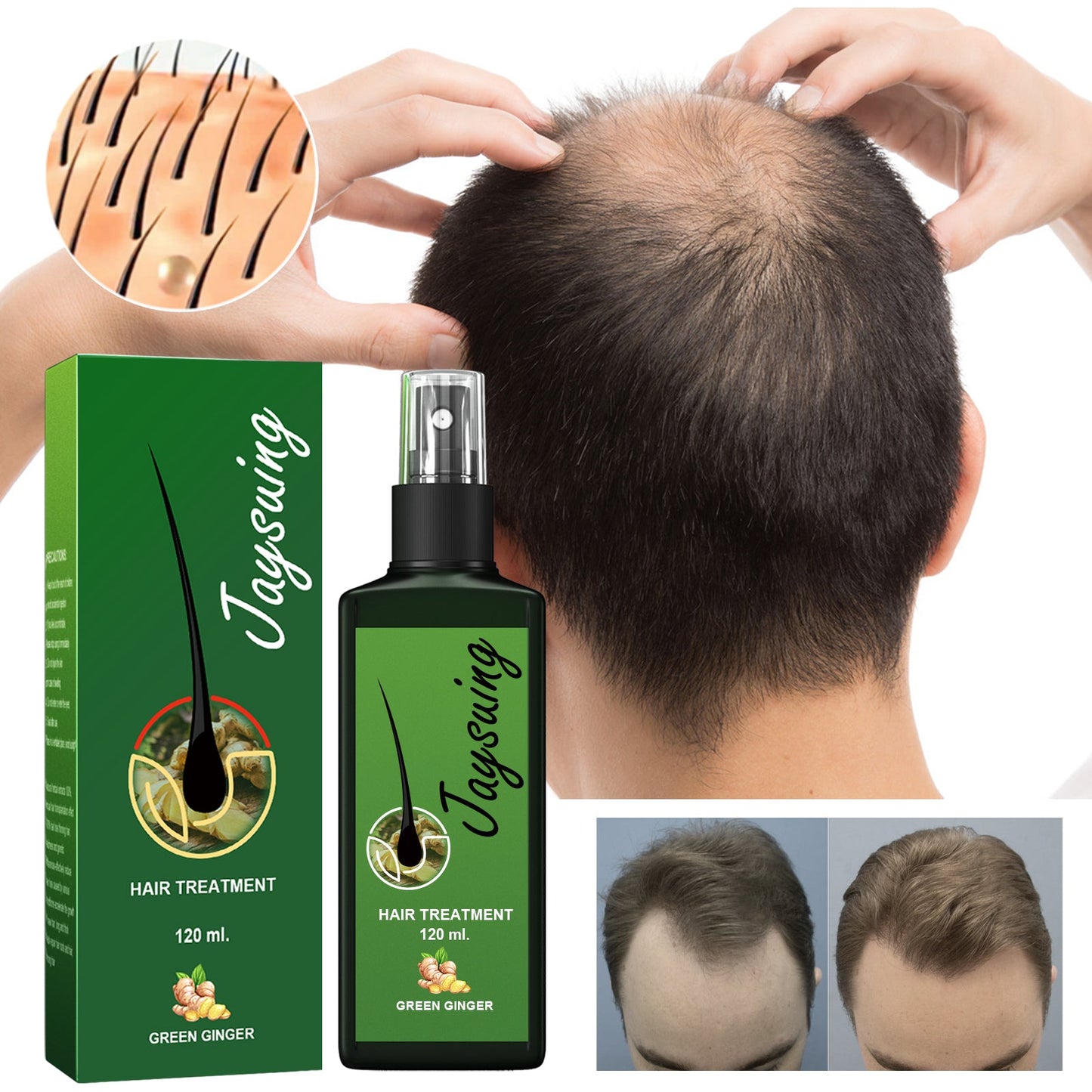 Hair Care Solution Gently Nourishes And Massages Scalp, Moisturizes And Softens Hair Care Spray - DivineLink1 | Electronics, Fitness, Household Essentials | Shop