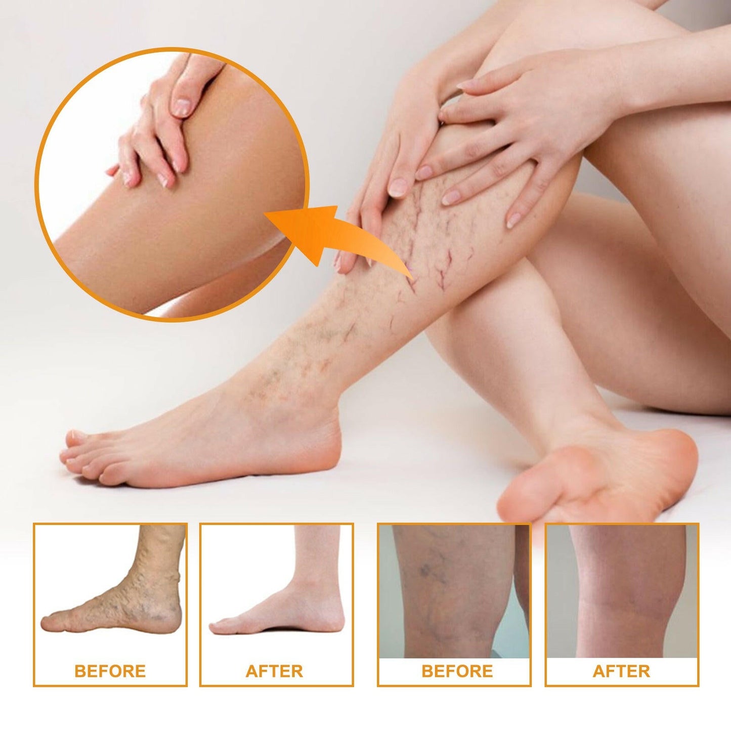 Vitamin K Cream Skin Care For Sore And Swollen Legs Earthworm Leg Vein Massage Cream - DivineLink1 | Electronics, Fitness, Household Essentials | Shop