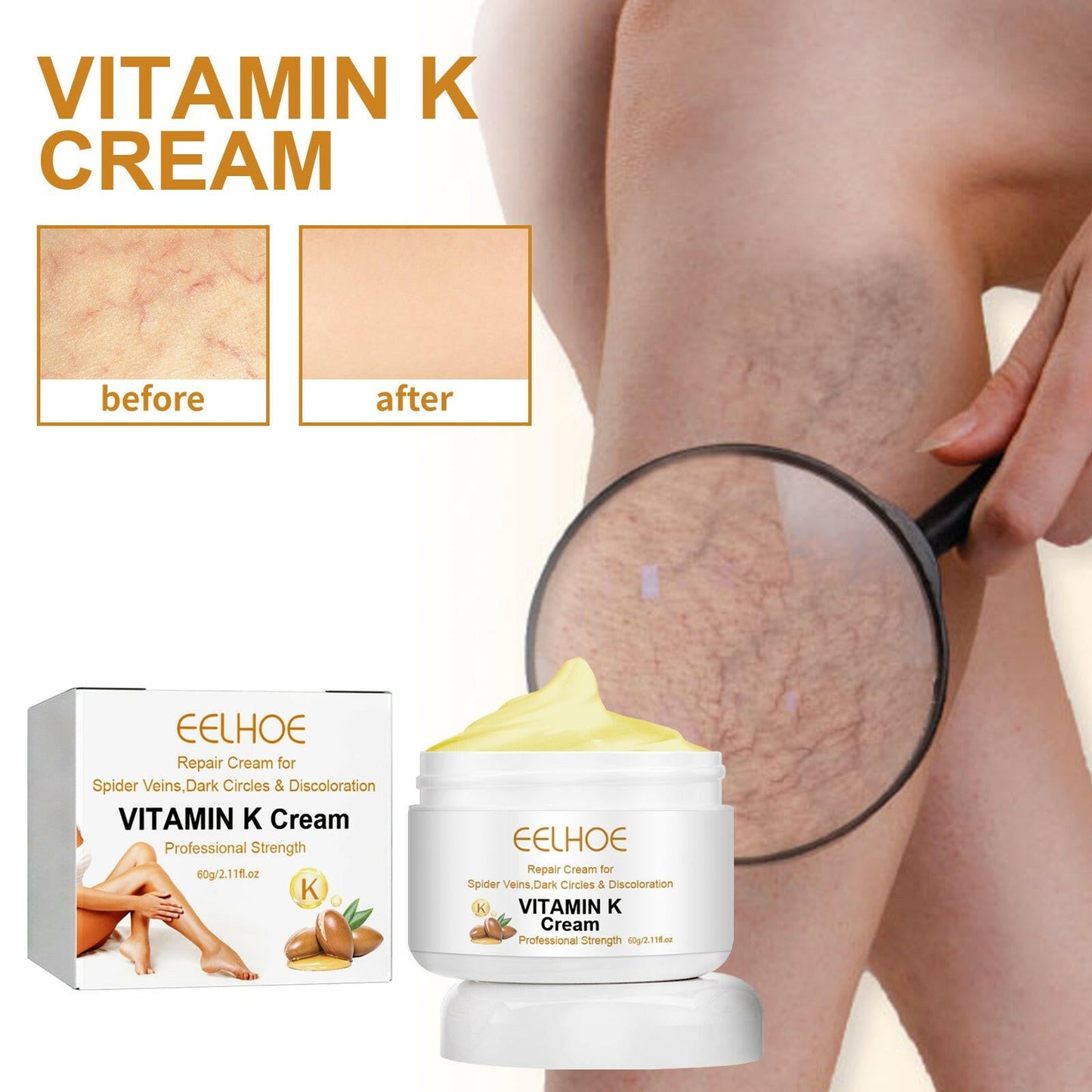 Vitamin K Cream Skin Care For Sore And Swollen Legs Earthworm Leg Vein Massage Cream - DivineLink1 | Electronics, Fitness, Household Essentials | Shop