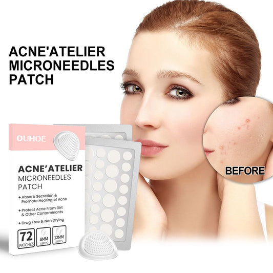 Acne Patch, Repair Acne Pimple Facial Redness Clean Pores Moisturize Skin Patch - DivineLink1 | Electronics, Fitness, Household Essentials | Shop