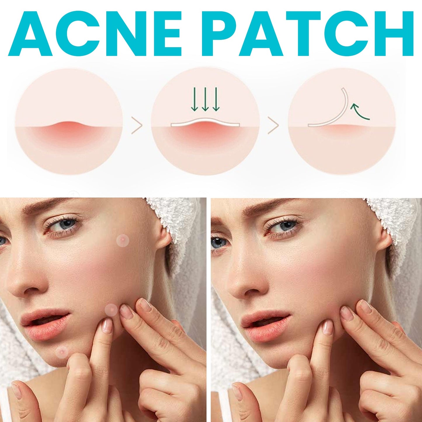 Acne Patch, Repair Facial Acne Invisible Concealer Hydrocolloid Patch - DivineLink1 | Electronics, Fitness, Household Essentials | Shop