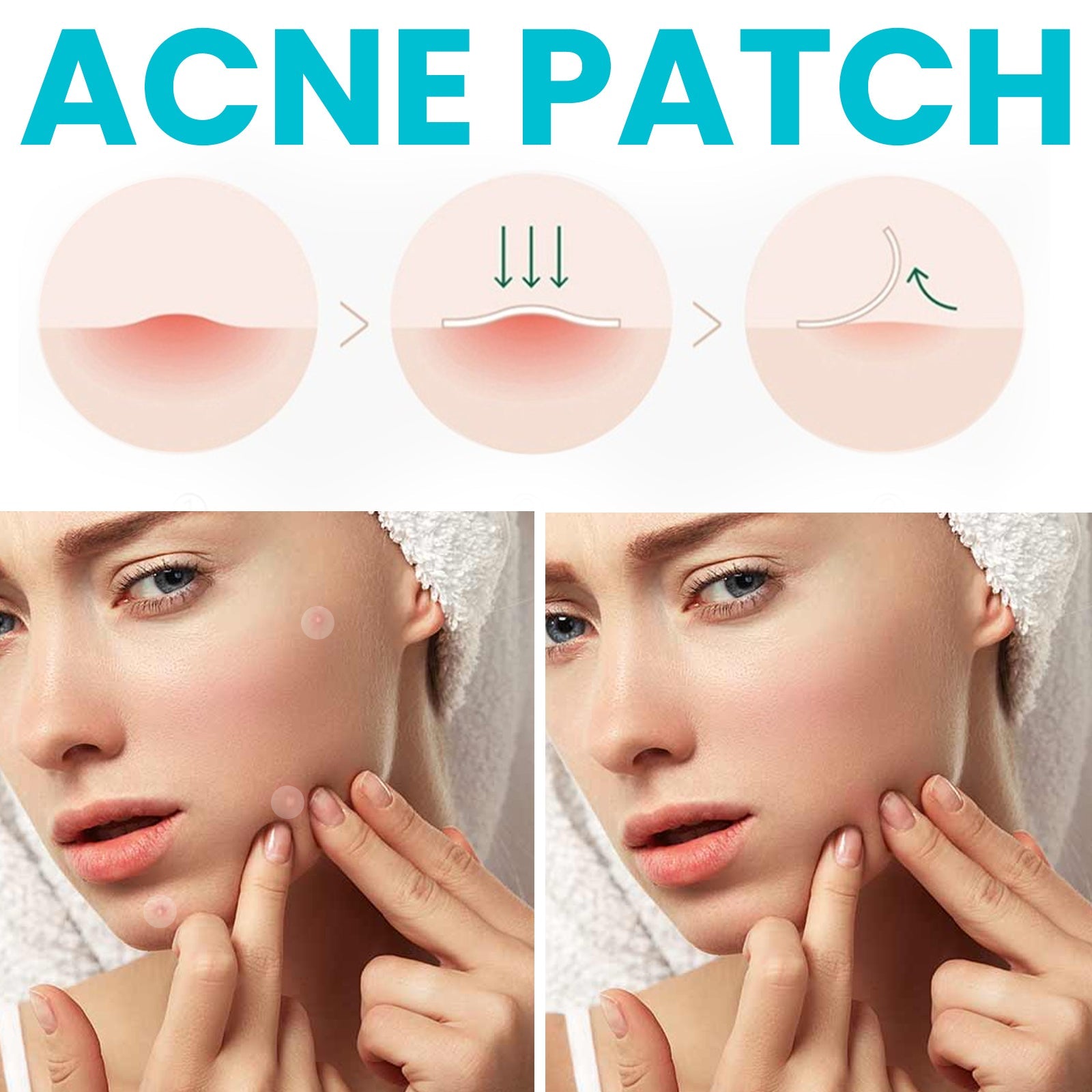 Acne Patch, Repair Facial Acne Invisible Concealer Hydrocolloid Patch - DivineLink1 | Electronics, Fitness, Household Essentials | Shop