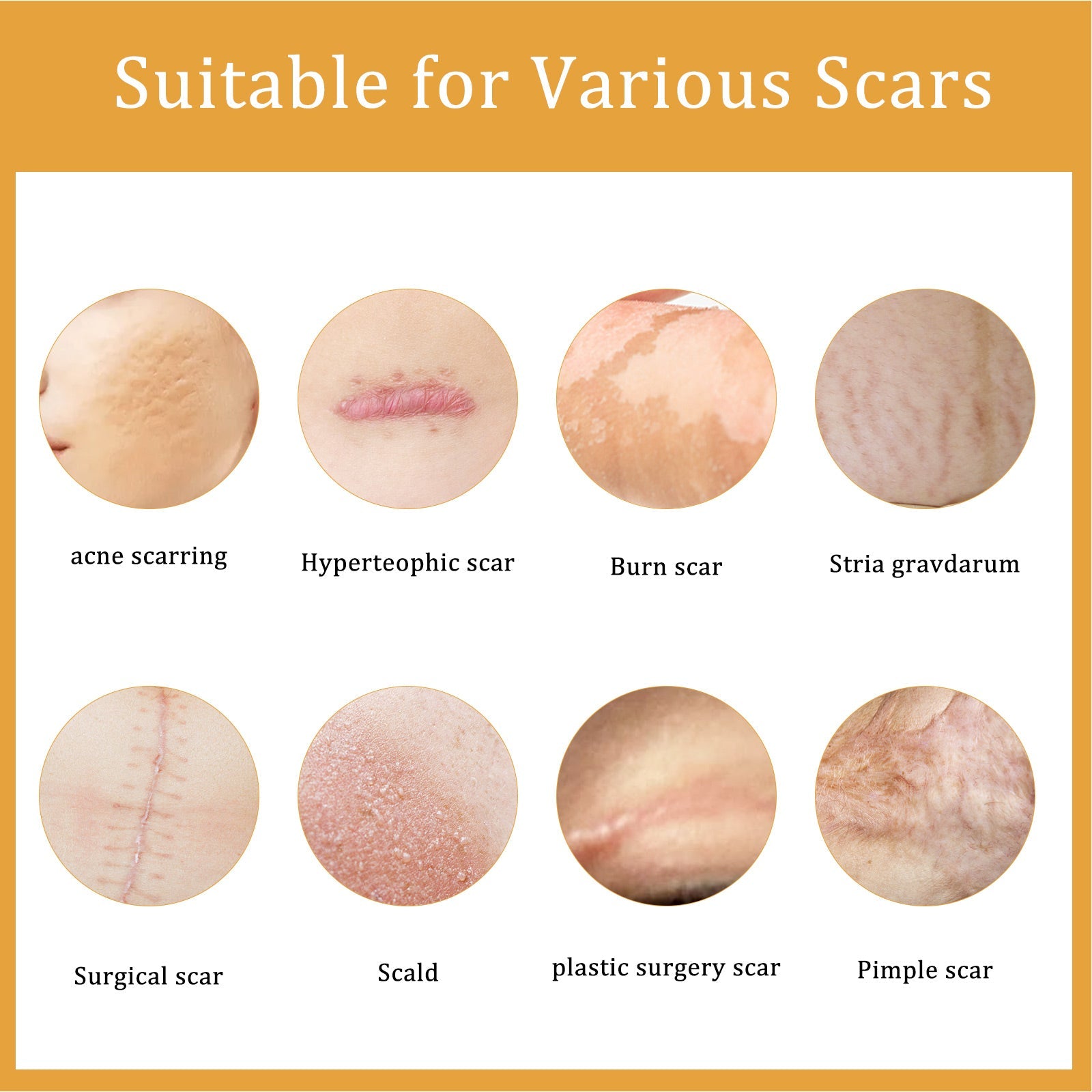 Desalting Skin Scar Cream, Skin Burn Scalding Surgical Scar Wound Repair Cream - DivineLink1 | Electronics, Fitness, Household Essentials | Shop